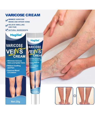  MagiSel Anti Varicose Veins Cream Varicose Veins Cream Varicose Veins Cream Varicose Veins Cream Varicose Veins Cream Varicose Veins Cream Varicose Veins Cream Varicose Veins Cream 20g - Buy Online on GoSupps.com