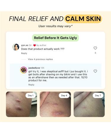 MyMagicHealer Complete Flare Care | Universal Flare & Universal Essential Oil Free Flare Care | Dual Relief for HS, Boils & Cysts, Eczema, Diaper Rash, Psoriasis, Impetigo | Drawing Salve (2 x 1oz) - Buy Online on GoSupps.com