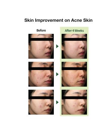 Lightweight Daily Moisturizer with Centella Asiatica | CICA Soothing Cream for Acne-Prone Skin | Rosacea Relief | 1.7Oz - THE LAB Blanc Doux - Buy Online on GoSupps.com