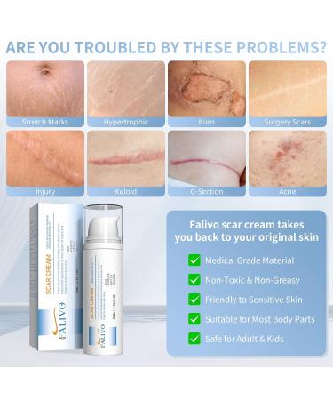Scar Cream 50g - Effective Silicone Gel for Surgical Scars Stretch Marks Acne & More - Fast Scar Removal for Face & Body - Buy Online on GoSupps.com
