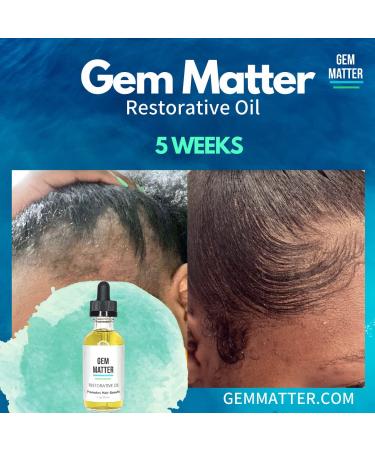Premium Restorative Oil for All Skin Types | Shop Internationally - Buy Online on GoSupps.com