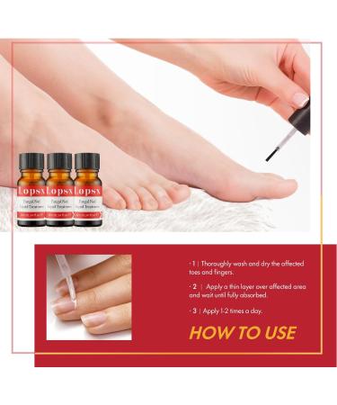 Mycose Ongles Des Pieds Lopsx Traitement Mycose Ongle Pied Puissant - Traitement Efficace pour Ongles Ab m s D color s et Fragiles 10ml - Buy Online on GoSupps.com