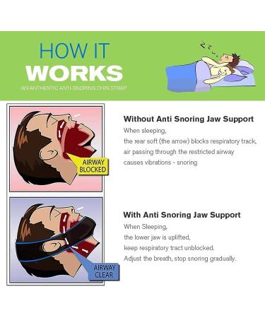 Adjustable Anti-Snoring Chin Strap | Breathable Stop Snoring Solution for Men and Women | Snore Reducing Device | One Size (Black-Grey) - Buy Online on GoSupps.com