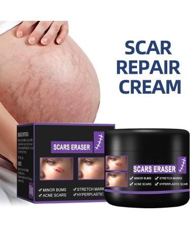 Scar Removal Cream 50ml - C-Section Skin Repair, Stretch Marks & Acne Surgery Treatment - Buy Online on GoSupps.com