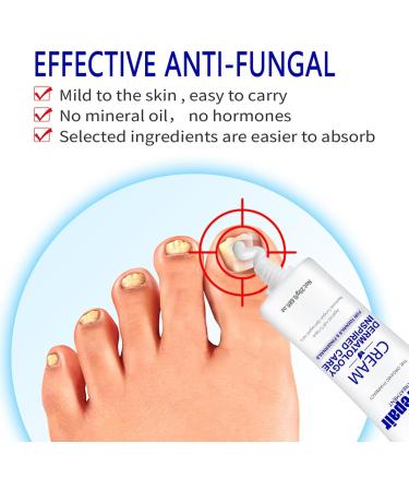 Fungal Nail Treatment Fungus Nail Cream Extra Strong Nail Fungus Treatment for Toenail Fix Renew Damaged Broken Anti Fungus Nail Repair - Buy Online on GoSupps.com