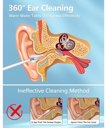 Electric Ear Wax Removal Kit - Triple Jet Stream, 3 Pressure Settings, IPX7 Water Resistant - USB Rechargeable - Buy Online on GoSupps.com