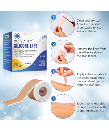 Silicone Scar Sheets & Tape 1.6x120 - Reusable Treatment for C-Section, Burn, Surgery & Acne Scars - Buy Online on GoSupps.com