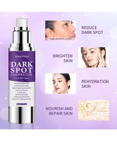 ASHEPANX Dark Spot Remover Cream for Face and Body - Melasma & Hyperpigmentation Treatment | Brightening & Moisturizing Formula | Age Spot & Sun Spot Corrector - Instant Results - Buy Online on GoSupps.com