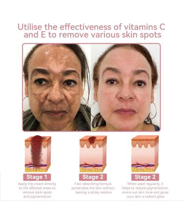 Awzlove Coenzyme Q10 Collagen Jelly Skin Cream Collagen Jelly Skin Cream Collagen Jelly Cream Niacinamide & Freeze-Dried Hydrolyzed Collagen for All Skin Types (1PC) - Buy Online on GoSupps.com