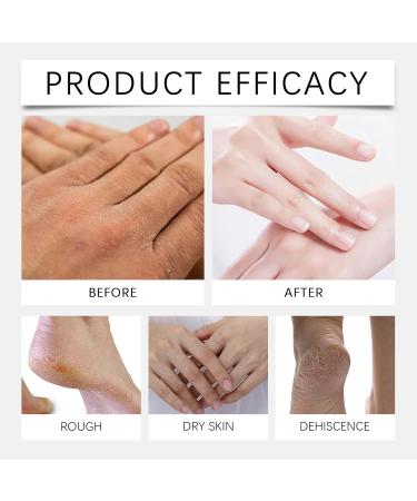  XINRAN Hand and foot cream for cracked skin moisturizing hand and foot care non-greasy moisturizing treatment Netz F ße Lotion for dry rough cuticles oil for heels dry cracked knees and elbows (2 pcs) - Buy Online on GoSupps.com