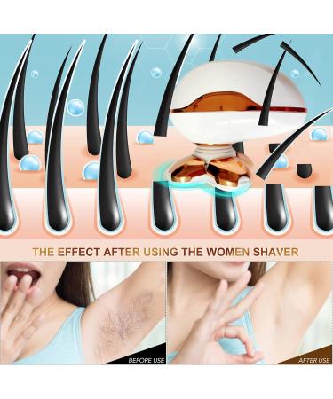 2021 Upgrade Electric Lady Shaver - Painless Bikini Razor & Cleansing Brush - Rechargeable and Cordless Women's Shaver for Hair Removal on Legs, Face, Body & Lips - Waterproof - Buy Online on GoSupps.com