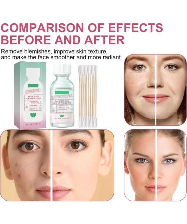 Nmbol Salicylic Acid Face Serum 3 - Buy Online on GoSupps.com