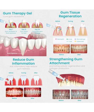 Lovilds Zefux Neslemy Dentiz & Fivfivgo Gum Therapy Gel | 2PCs for Optimal Gum Health | International Shipping - Buy Online on GoSupps.com