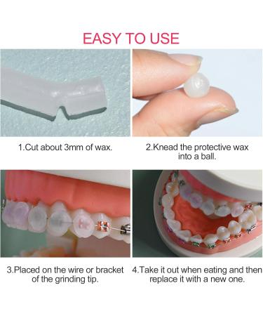 Newpop 10pcs Orthodontic Wax for Braces - Relieve Irritation & Pain | Dental Wax for Comfortable Wear - Buy Online on GoSupps.com