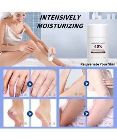 Urea Foot Cream Cracked Heel Balm Urea 40% Cream Cracked Heel Repair Cream Feet Skin Remover Callus Remover Foot Cream for Dry Skin Moisturizing Crack Cream Foot Care - Buy Online on GoSupps.com