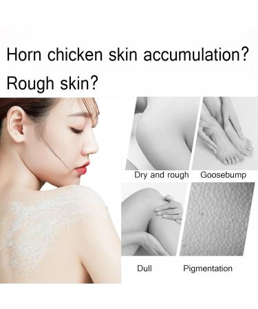 keratosis Pilaris Body Scrub Pomegranate Bump Eraser Body Scrub for Strawberry Legs Reshaping the Skin and Smooth Bumpy Dry Skin Hydrate & Smooth Skin Skin-Polishing Care 10.5 oz - Buy Online on GoSupps.com