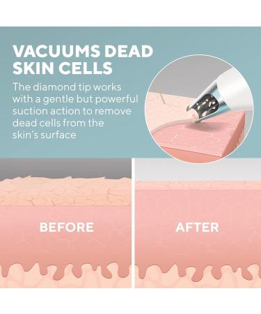 House of Marley Homedics Microdermabrasion Device - Revitalize Skin Smooth Wrinkles & Enhance Tone - Buy Online on GoSupps.com