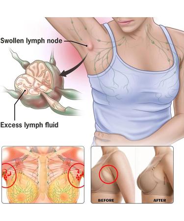 Herbal Lymph Nodes Patch for Kids - 24 Patches | Natural Support for Boys and Girls - Buy Online on GoSupps.com