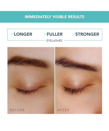 Buy FOREO IRIS Eyelash Serum - Volume Strength & Growth for Lashes & Brows - Phytokeratin & Arginine - Fragrance Free - 0.15 fl. oz - International Shipping Available - Buy Online on GoSupps.com