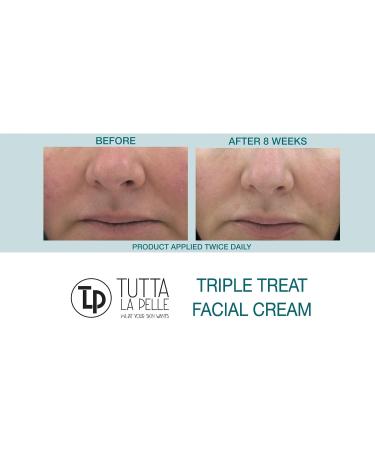 Buy Anti Aging Face Cream - Triple Antioxidant Serum with Resveratrol Green Tea & Caffeine - Reduces Redness & Soothes Sensitive Rosacea Skin - 1oz - Buy Online on GoSupps.com