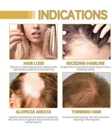 Vegan Natural Hair Growth Oil Vegan Hair Growth Oil Hair Oil Rosemary Hair Growth Oil For Dry Damaged Hair And Grow Thin Hair 2fl Oz 60 Ml 3 pcs - Buy Online on GoSupps.com