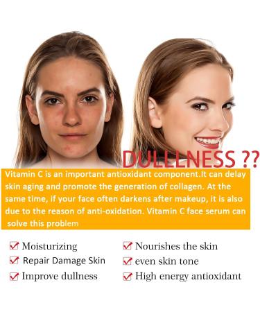 Vitamin C Face Serum Antioxidant Face Serum for Dullness Acne Facial Serum Anti Ageing & Smooth Fine Lines Hyaluronic Acid Serum for Face Firming Face Serum for Wrinkle Promote Skin Elasticity-30ml - Buy Online on GoSupps.com