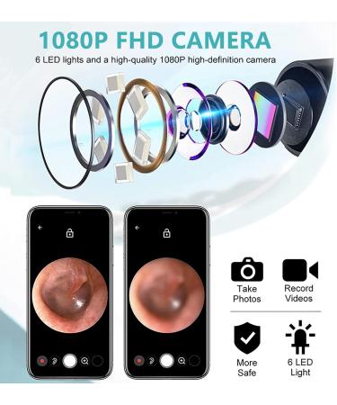WiFi Ear Wax Removal Kit with Camera | 6 LED Otoscope | IP67 Waterproof | App Control | Suitable for Adults, Kids, Pets | Black - Buy Online on GoSupps.com