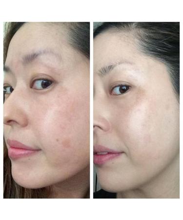 AntiAging Peel Pads-30% Glycolic Cell Renewal Peel Pads+ Salicylic Lactic Acid Argireline DMAE 50 Count (Pack of 1) - Buy Online on GoSupps.com