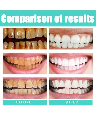 Coconut-Mint Mouth Care Set | Teeth Whitening Fresh Breath & Tongue Scraper - 100ml - Buy Online on GoSupps.com