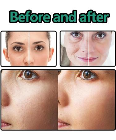 Face Brightening Solution | 30ml to Evenen Skin Tone Facial Spots - for Day Night Travel Home Women Women - Buy Online on GoSupps.com