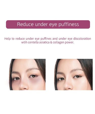 Veraclara Powerful Collagen Eye Patches - Reduce Puffy Eyes, Dark Circles, Wrinkles - 5 Pairs | Under Eye Treatment for Revitalized Skin - 1 Pack - Buy Online on GoSupps.com