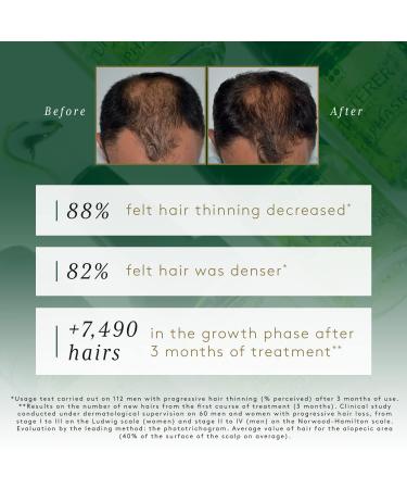 Ren Furterer TRIPHASIC Progressive Concentrated Serum for Hereditary & Hormonal Thinning Hair - 30-Day Supply, 8 ct. Pack - Buy Online on GoSupps.com