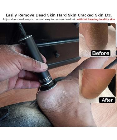 Adjustable Speed Electric Callus Remover with 60 Sandpaper Disks - Professional Foot File Pedicure Tool (FCR-02 Black) - Buy Online on GoSupps.com