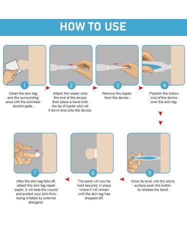 Remove Stem Warts Fast Kit | 2-in-1 Skin Day Remover for Micro to Large Warts (1mm-8mm) | Safe & Painless | 60-Day Bands Included - Buy Online on GoSupps.com