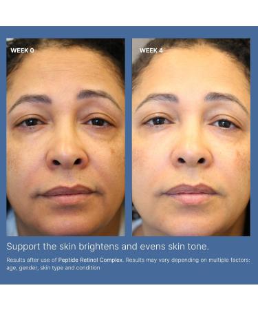 Nu Skin | ageLOC Tru Face Peptide Retinol Complex | 1 Fl Oz | Serum Skincare | Anti Aging Face Serum | Pore Minimizing | Peptide Facial Skin Care Product - Buy Online on GoSupps.com