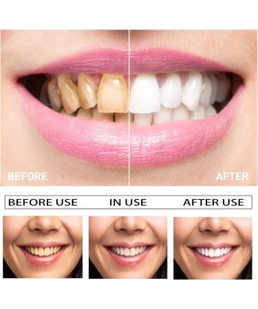 Teeth Whitening Abbey - 2-Piece Whitening Pen Set | Effective Stain Removal & Brightening Gel for White Teeth - Buy Online on GoSupps.com