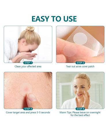 Acne Pimple Patches 180 Patches - Invisible Hydrocolloid Zit Patch for Face (5 Packs) | 2 Sizes Included - Buy Online on GoSupps.com