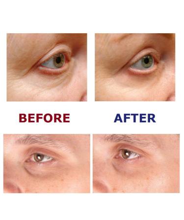 Under Eye Repair Cream with All-Trans-Retinol for Dark Circles, Puffiness & Wrinkles - 0.5 Oz - Buy Online on GoSupps.com