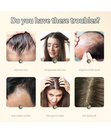 Ginger Plant Extract Anti-Hair Loss Hair Shampoo Ginger Plant Anti-Hair Loss Hair Shampoo Anti-Hair Loss And Hair Strengthening Shampoo Ginger Shampoo For Hair Growth - Buy Online on GoSupps.com