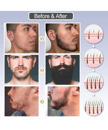Beard Growth Serum for Men - Accelerate Beard Growth with 30ml Beard Oil & Hair Growth Formula - Buy Online on GoSupps.com
