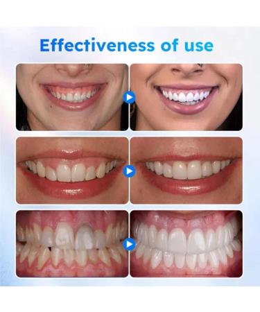 Zauzeta Oral Gum Treatment Gel - Repairs Gums Relieves Pain & Whitens Teeth (1PC) - Buy Online on GoSupps.com