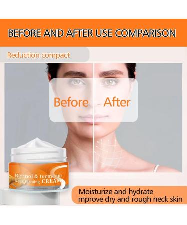 Retinol Neck Cream Neck Creams for Tightening and Firming Rosemary Neck & Moisturizer with Collagen Peptides Day & Night Skin Tightening & Lifting for Women for Sagging Aging Skincare(50ML) - Buy Online on GoSupps.com