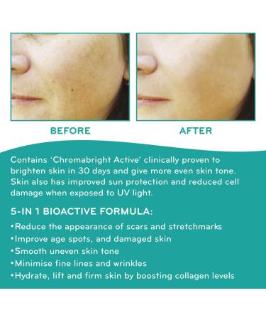 SkinWorks Natural Superfood Rosehip Facial Oil Anti Ageing Treatment to Help Acne Scars Stretch Marks and Fine Lines on Face 30ml - Buy Online on GoSupps.com