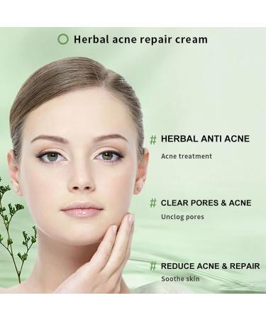Chinese Herbal Acne Treatment Cream Natural Extract Acne & Spot Treatment for Face Acne Cream & Spot Cream for Face Pimple Cream for All Skin Types Smooth Gentle Acne Repair Oil Control - Buy Online on GoSupps.com