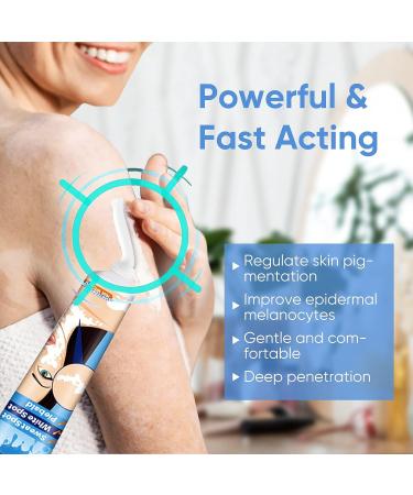 Vitiligo Cream for Skin Treatment and Pigmentation Care - Buy Online on GoSupps.com