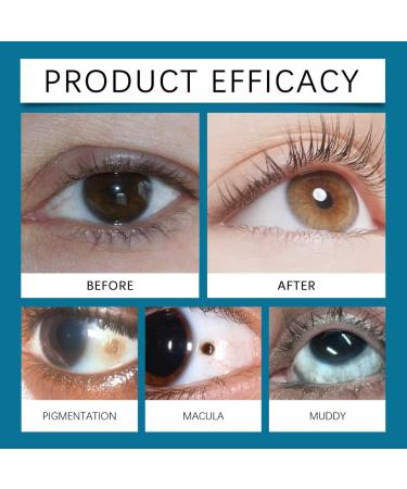 Vitamines pour les yeux - Lut ine avec z axanthine pour adultes et seniors 2PCS - Buy Online on GoSupps.com