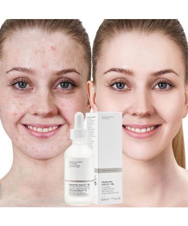 Hyaluronic Acid 2% + B5 Hyaluronic Acid Serum for Face Hydrated Skincare Serum Moisturiser Face Hyalu B5 Serum to Plump and Smooth Skin Hydrating Serum Anti Aging Serum for Face Brightening Serum - Buy Online on GoSupps.com