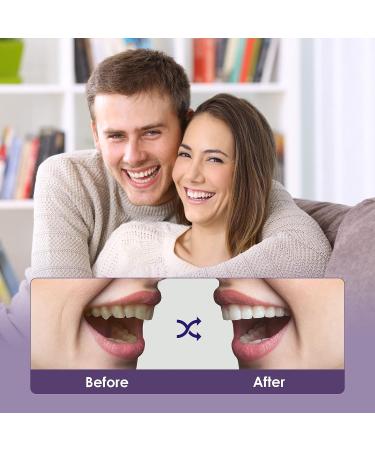 2PCS Fake Teeth Dentures for Women and Men - Temporary Dental Veneers for Natural, Comfortable Restoration. Regain Your Confident Smile with Teeth Protection. Natural Shade-4 - Buy Online on GoSupps.com