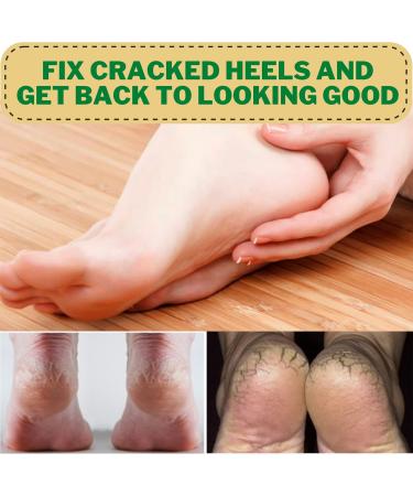 Buy Heel Cups Sleeves - Fabric Heel Cushions for Pain Relief | Support Plantar Fasciitis & Achilles Tendinitis | Men & Women - Large Blue - Buy Online on GoSupps.com