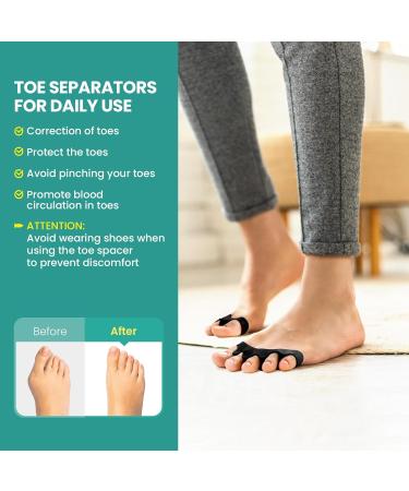 Welnove Toe Separators Bunion Corrector - 8 Pcs Gel Straighteners for Hammertoes | Buy Now for Pain Relief & Correct Foot Alignment - Buy Online on GoSupps.com